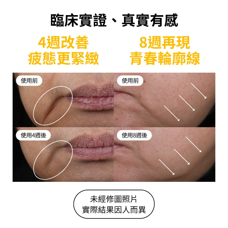 StriVectin皺效奇蹟 皺效緊緻繃繃臉霜 50ml
