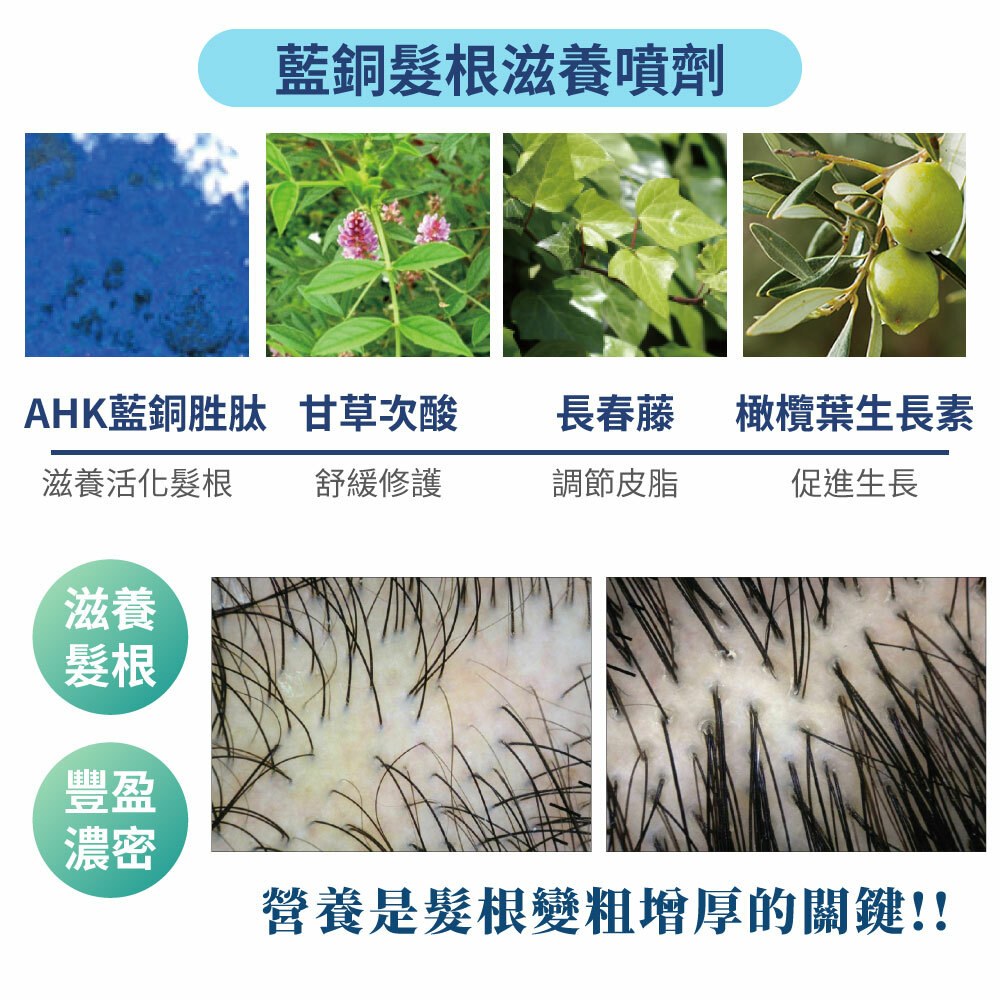Follimin髮利明 藍銅髮根滋養噴劑