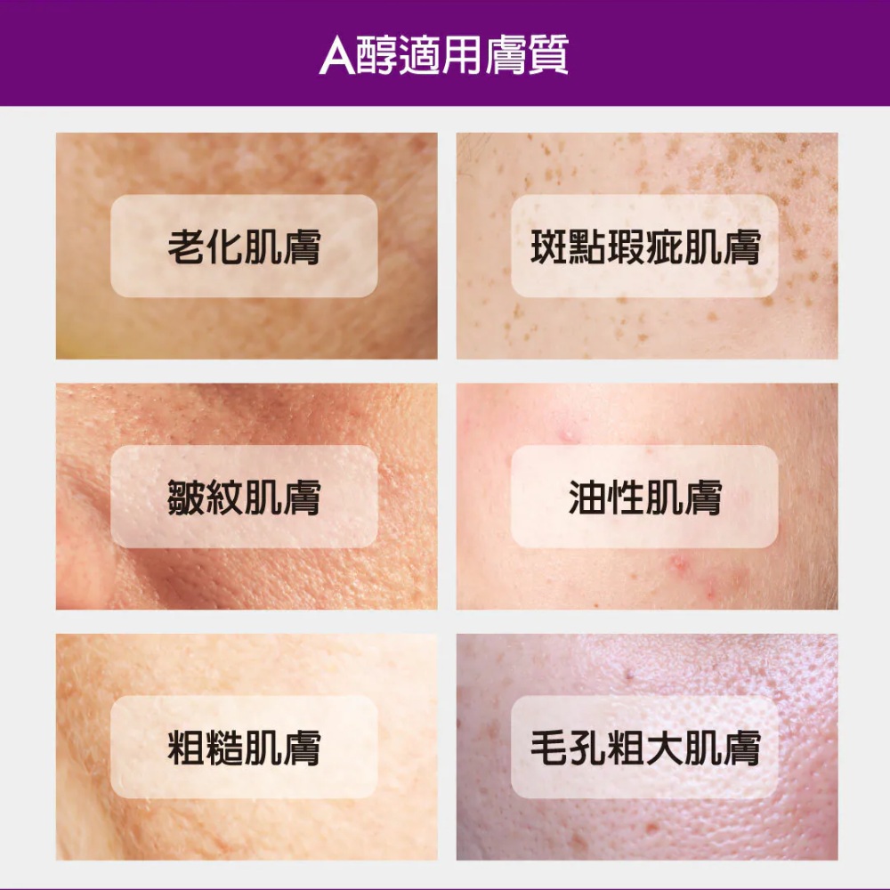 妮傲絲翠 A醇全效肌活菁萃 35gm